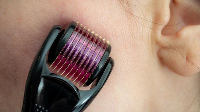 Dermaroller nedir, ne işe yarar? Dermaroller nasıl kullanılır?