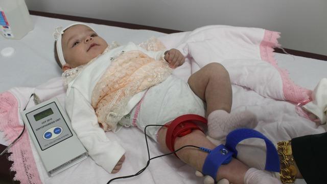 Aman dikkat: Her 3 bin bebekten birinde görülen 'kistik fibrozis'te erken tanı hayat kurtarıyor!