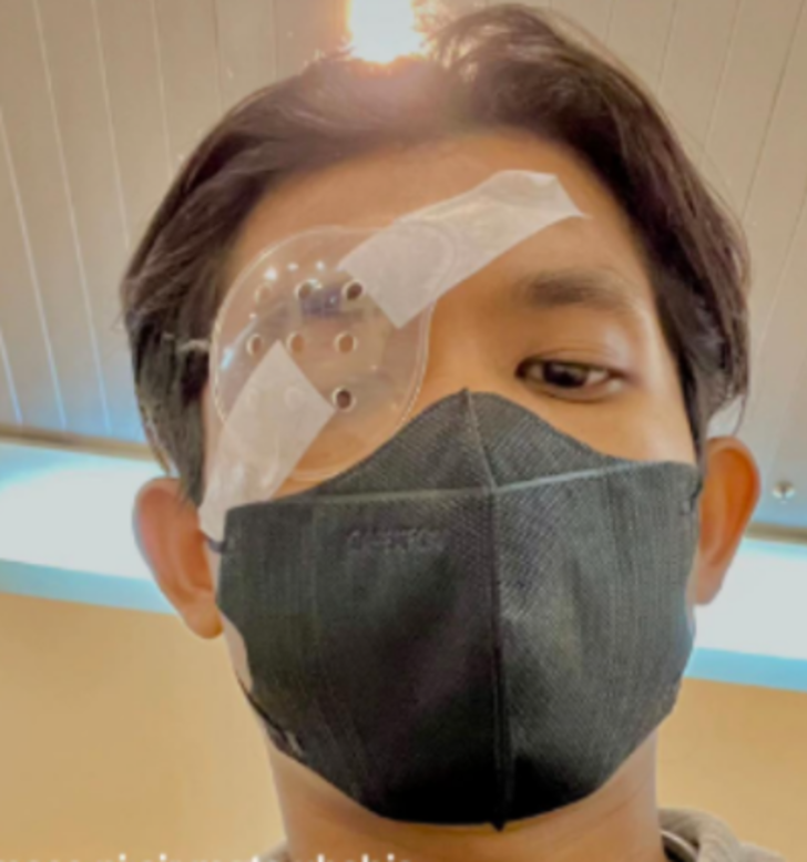 G&ouml;z&uuml;n&uuml; ovuştura ovuştura korneasında yara oluşturdu! Bulanık g&ouml;rmeye başladığında doktora gitti: Kornea nakli yaptırmak zorunda kaldı