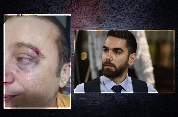 Olay iddia! Onur Akay 'mason' demişti, saldırıya uğradı! "Kadir Doğulu i&ccedil;in, tarikat i&ccedil;in"