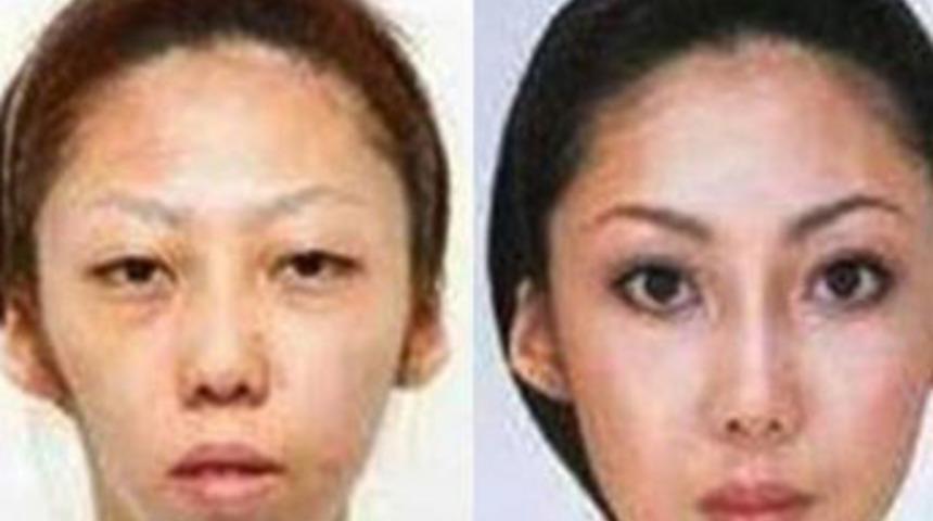 Estetikle kandırdığı eşine tazminat ödeyecek