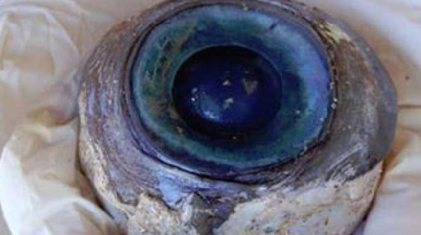 Sırrı 6 g&uuml;nde &ccedil;&ouml;z&uuml;ld&uuml;