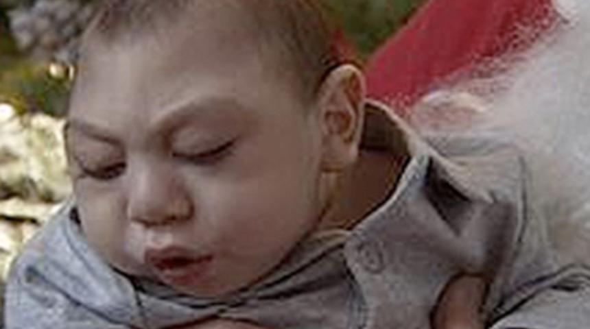 'Mucize &ccedil;ocuk' yaşamını yitirdi