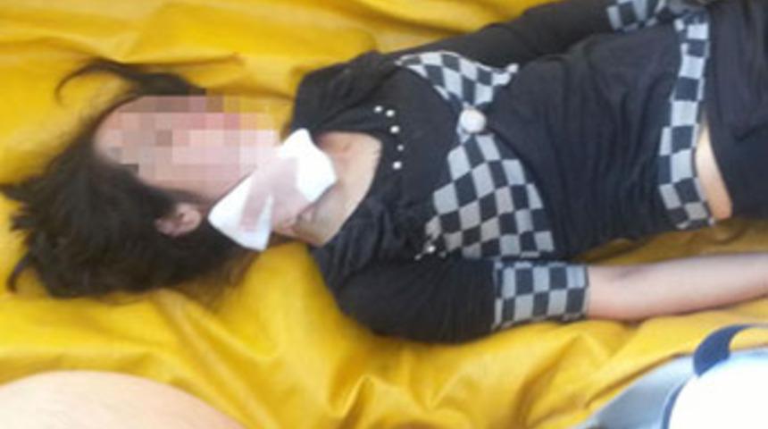 Cam par&ccedil;asıyla kendi boğazını kesti