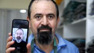 O tedaviden sonra... Beyaz olan saçı ve sakalı siyaha döndü! Şaşkınlık yaşadı 'Görenler 55 yaşında olduğuma inanmıyor'