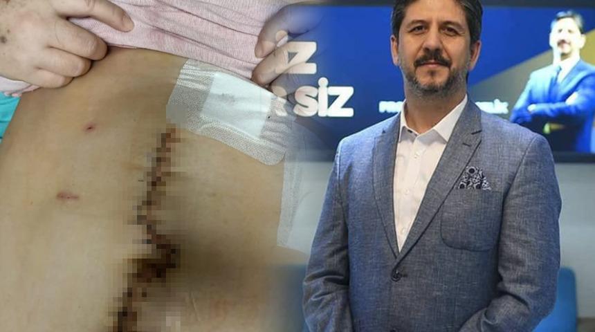 O doktorun bir mağduru daha ortaya çıktı!  Hülya Güneri'nin hayatı karardı: 'Beni yarım bir insan haline getirdi'