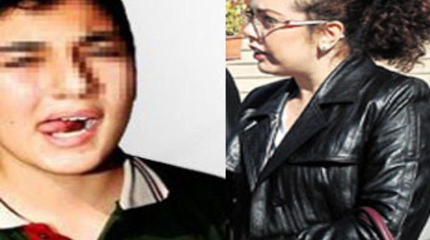 &Ouml;ğrencisinin dilini kesen &ouml;ğretmen