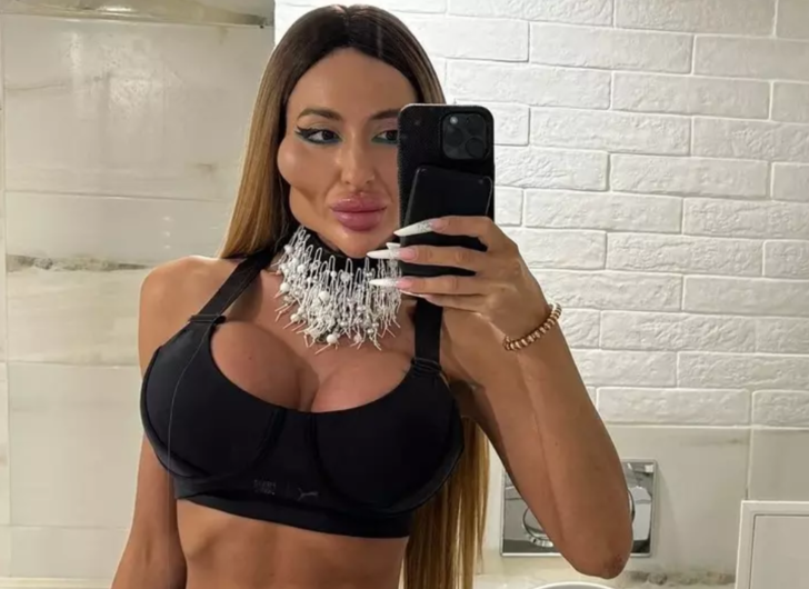 Dünyanın en büyük yanaklı modeli Anastasia Pokreshchuk'un estetiksiz hali görenleri şaşkına çevirdi