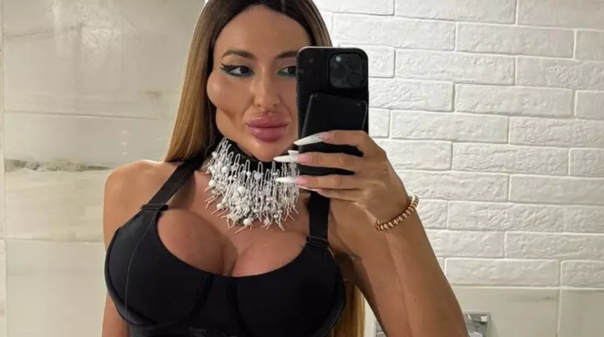 D&uuml;nyanın en b&uuml;y&uuml;k yanaklı modeli Anastasia Pokreshchuk'un estetiksiz hali g&ouml;renleri şaşkına &ccedil;evirdi