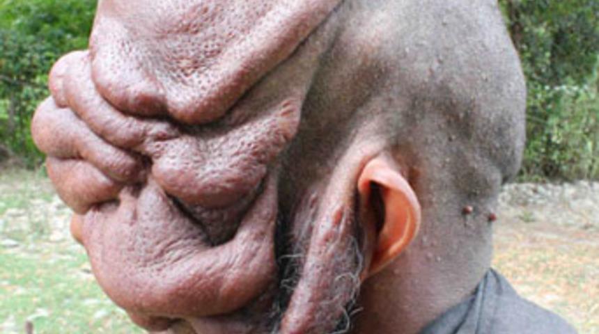 Talihsiz bir hastalığın pen&ccedil;esinde