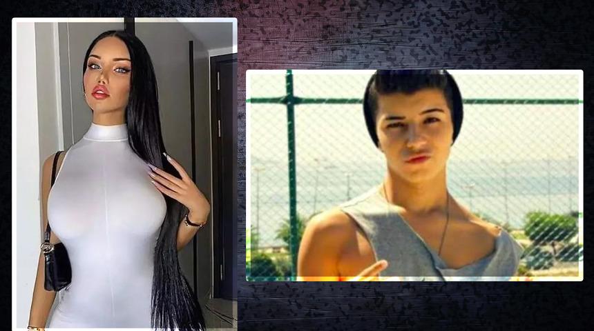 Fenomen Beren G&uuml;ney cinsiyet değiştirmişti... Son hali dikkat &ccedil;ekti: Dolguların g&ouml;beğime, belime, bacaklarıma aktığını g&ouml;rd&uuml;m