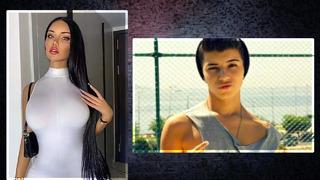 Fenomen Beren Güney cinsiyet değiştirmişti... Son hali dikkat çekti: Dolguların göbeğime, belime, bacaklarıma aktığını gördüm