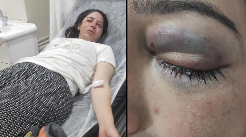 Çocuk yaşta evlendi, kuzeni üzerine kuma getirildi, eşinden şiddet gördüğü için kaçtı bu kez de kardeşinden dayak yedi