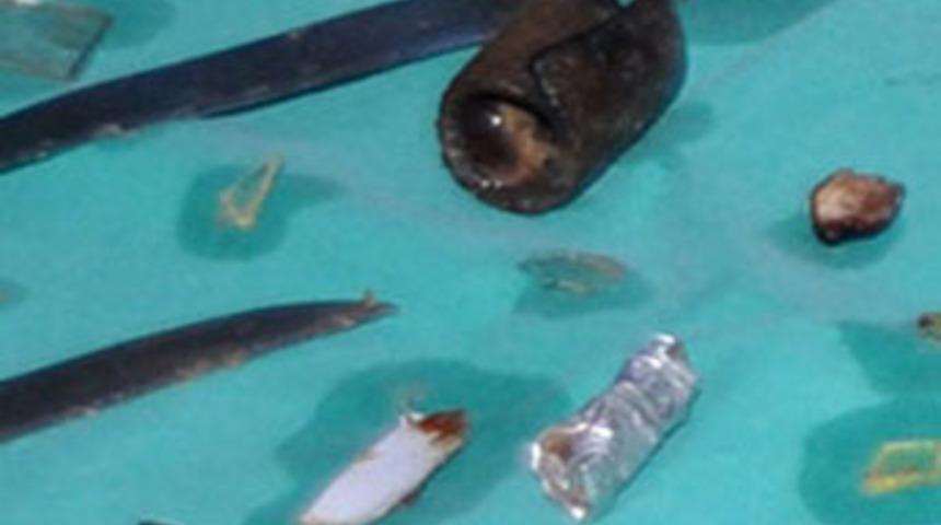 Eline ne geçtiyse yutmuş