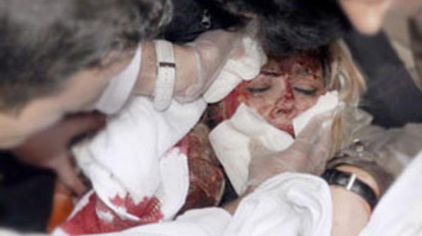 'Kezzap atacağım' diyordu, falçatayla kesti