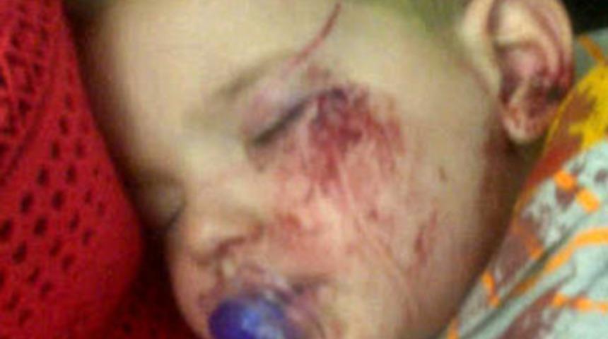 2 yaşındaki &ccedil;ocuğa şahin saldırdı