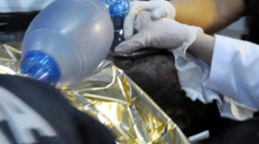 Üniversite öğrencisi kampüste kendini yaktı