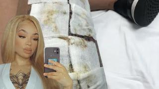 Bacağına dövme yaptırırken hastanelik oldu! Enfeksiyon kapınca kabusu yaşadı... Çürümüş et gibi kokuyordu