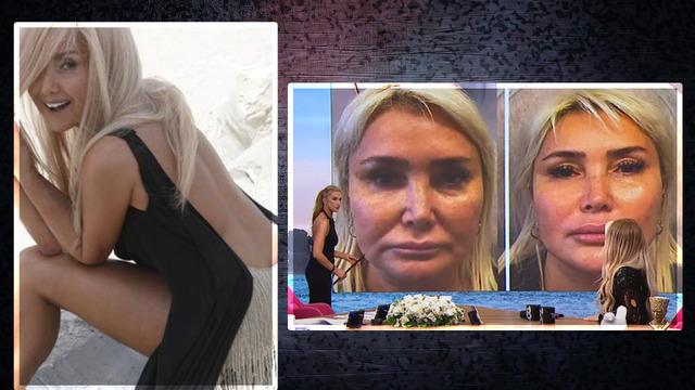 Bebek kordonundan kök hücre yaptırmıştı... Yonca Evcimik estetiklerini tek tek saydı! Ünlü sunucu inanmayıp yeniden sordu