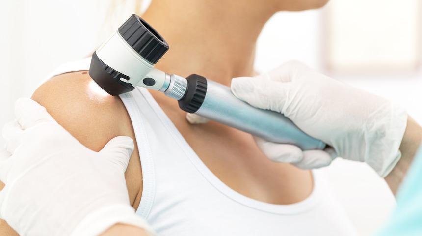 Cilt kanseri belirtileri nelerdir? Cilt kanseri tedavisi nasıl yapılır?