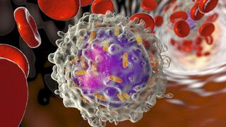 Lösemi belirtileri nelerdir, lösemi nasıl anlaşılır? Lösemi tedavisi