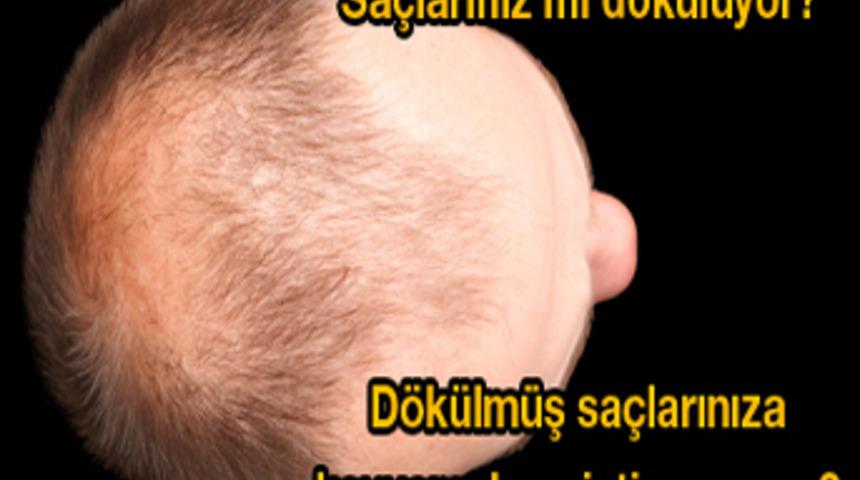 Artık Kelin Tarağa İhtiyacı VAR!