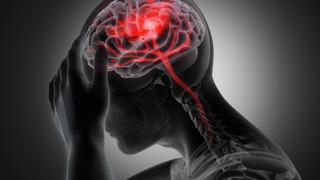 Beyin kanaması belirtileri nelerdir? Beyin kanaması olursa ne olur? Beyin kanaması tedavisi
