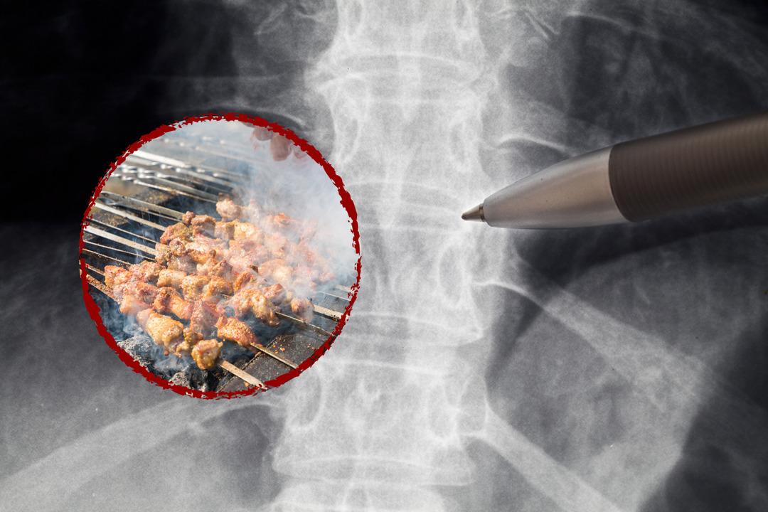 Mangal keyfi &ouml;l&uuml;mle sonu&ccedil;lanıyordu! Bir par&ccedil;a tavuk yedi sesini kaybetti... Herkesin başına gelebilir: Sakın bu hatayı yapmayın! 