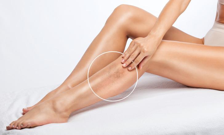 6) &Ouml;R&Uuml;MCEK TİPİ VARİSLER