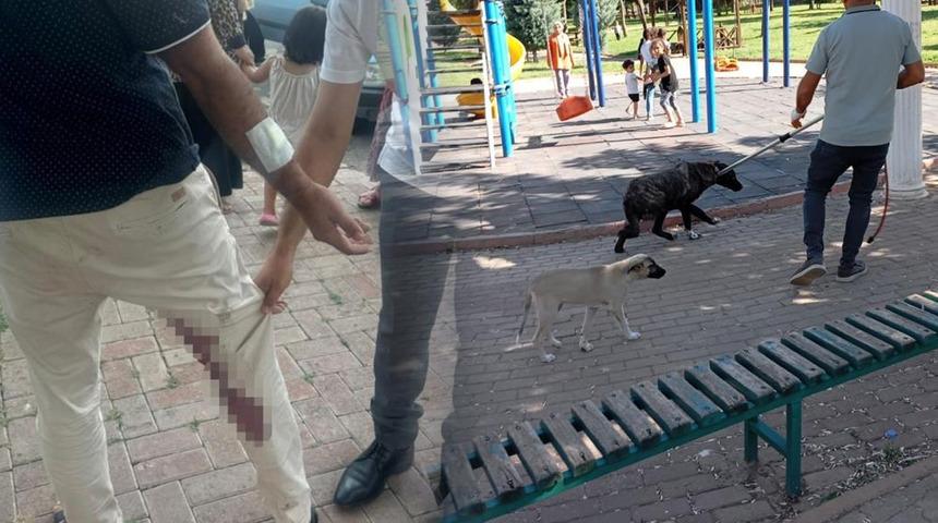 Şanlıurfa'da 'kuduz' alarmı! Saldıran köpek öldü, vatandaş tedavi altına alındı