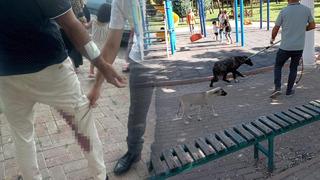 Şanlıurfa'da 'kuduz' alarmı! Saldıran köpek öldü, vatandaş tedavi altına alındı