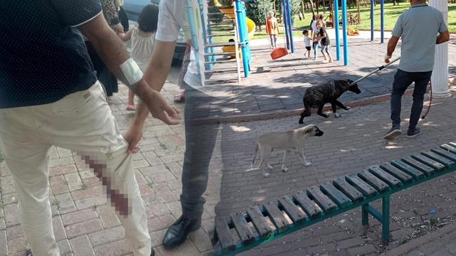 Şanlıurfa'da 'kuduz' alarmı! Saldıran köpek öldü, vatandaş tedavi altına alındı