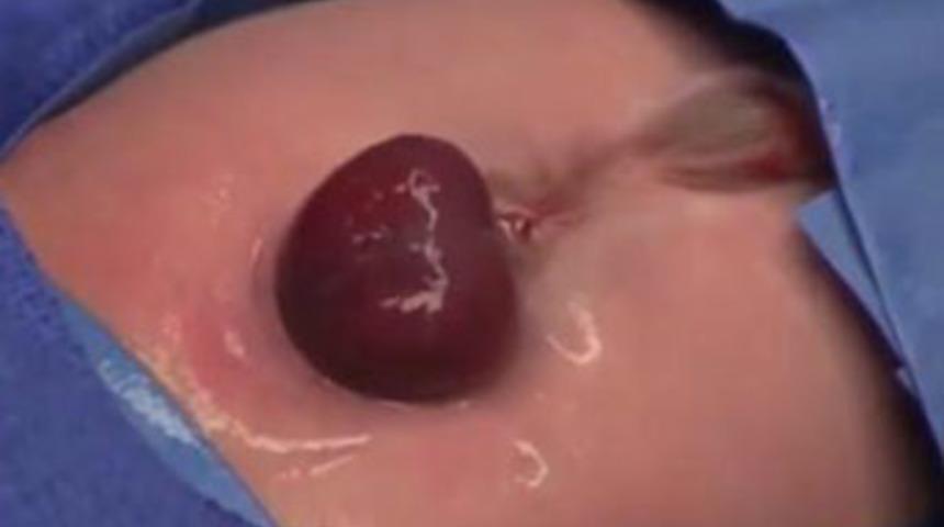 D&uuml;nya bu bebeği konuşuyor!