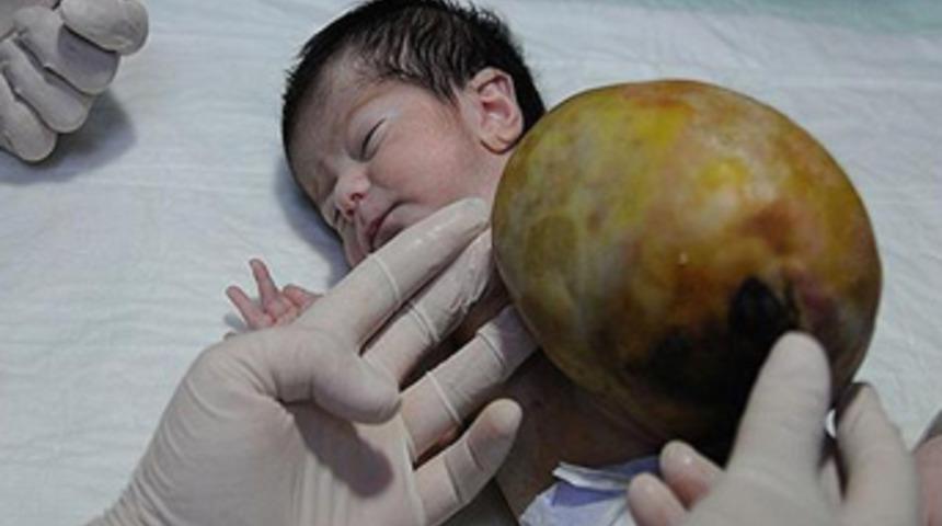 Organları kesesinde