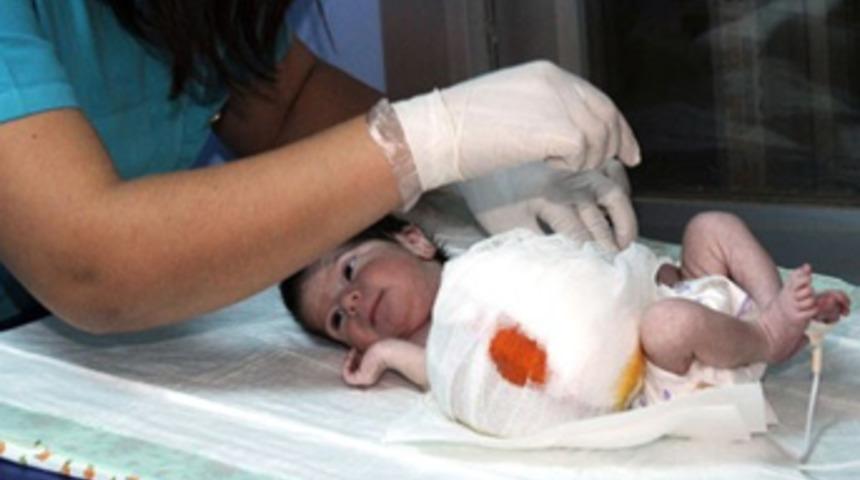 Organları dışarda doğdu!