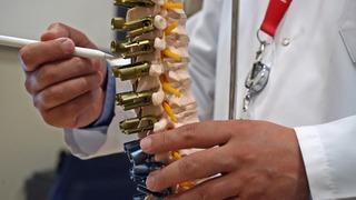 Aman dikkat! Denize giren çocuğunuzun vücudunda bu belirti varsa skolyoz olabilir