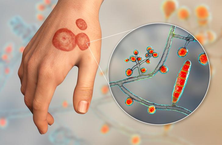 Yeni bir t&uuml;r ortaya &ccedil;ıktı... İlk vaka haberi ABD'den! Son derece bulaşıcı