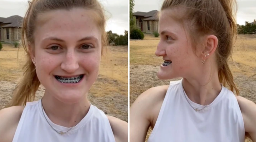 O eski halinden eser yok! Çene ameliyatının sonuçlarını gösterdi... Gören inanamadı: "Resmen evrim geçirmiş"