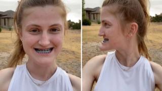 O eski halinden eser yok! Çene ameliyatının sonuçlarını gösterdi... Gören inanamadı: Resmen evrim geçirmiş