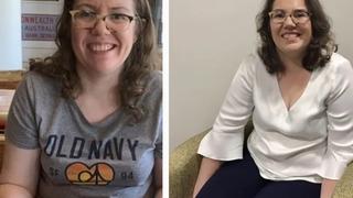 Anne rahmindeki halini bile hatılıyor! Bir fetüs olduğum zamanlarda diyerek anlattı... Dünyada sadece 62 kişide var