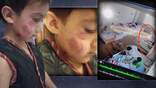 4 yaşındaki kız çocuğunun yaptığını görenler pitbull sandı! Anaokulunda uyuyan erkek çocuk kabus yaşadı