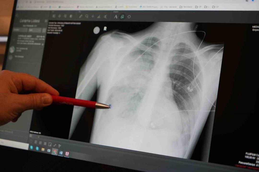 Modern tıpta bile ciddi bir tehdit: Yüksek ölüm oranlarıyla dikkat çekiyor! 2