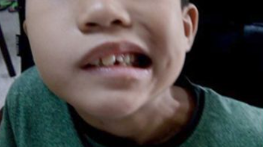 Sıcak havalardan bunalan ailesi çareyi klimayı açmakta buldu! 8 yaşındaki çocuk soğuktan felç geçirdi... "Klimanın sıcaklığına dikkat edin"