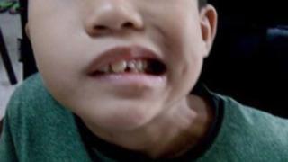 Sıcak havalardan bunalan ailesi çareyi klimayı açmakta buldu! 8 yaşındaki çocuk soğuktan felç geçirdi... Klimanın sıcaklığına dikkat edin