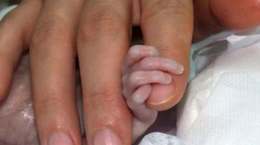 Gerçek parmak çocuk