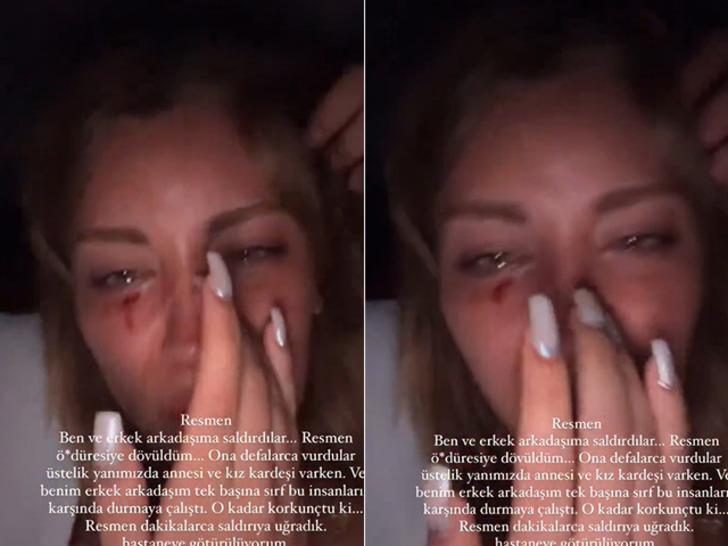 Mika Raun kanlar içinde video paylaştı! "Öldüresiye dövüldüm, defalarca vurdular..."