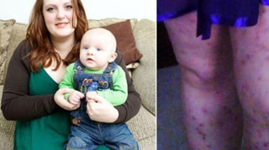 Kendi bebeğine alerjisi var!