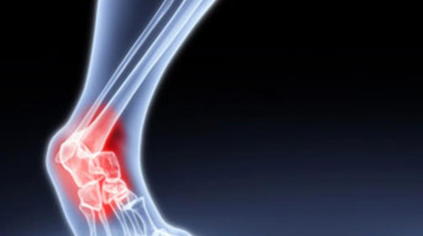 Romatizmal ağrılara bitkisel tedaviler