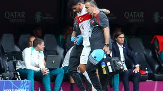 Milli takımda birde sakatlık şoku! Samet Akaydın oyuna devam edemedi, Çekya maçında...