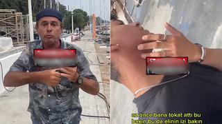 Ayhan Sicimoğlu'ndan personeline tokatlı saldırı! Darp raporu alacağım